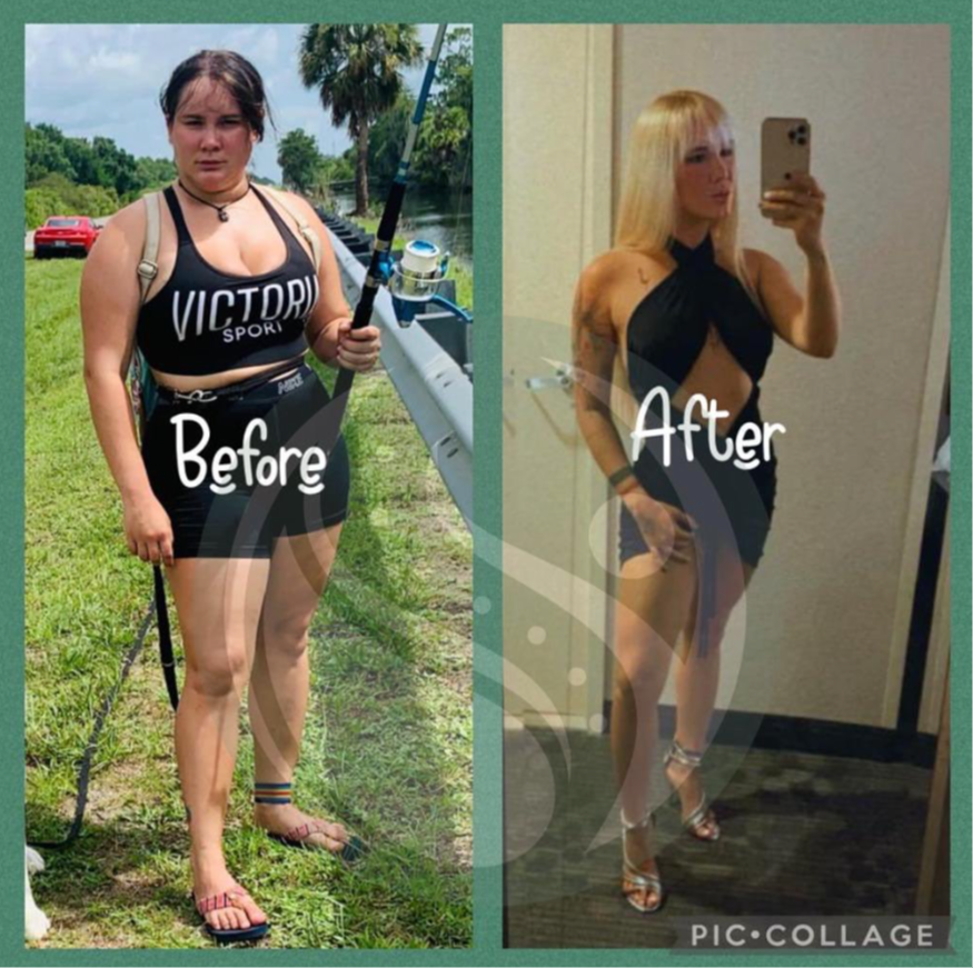 Antes y después — paciente 6