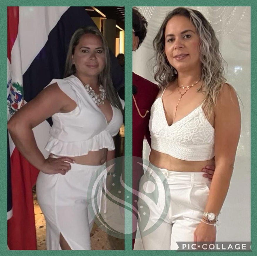 Antes y después — paciente 5