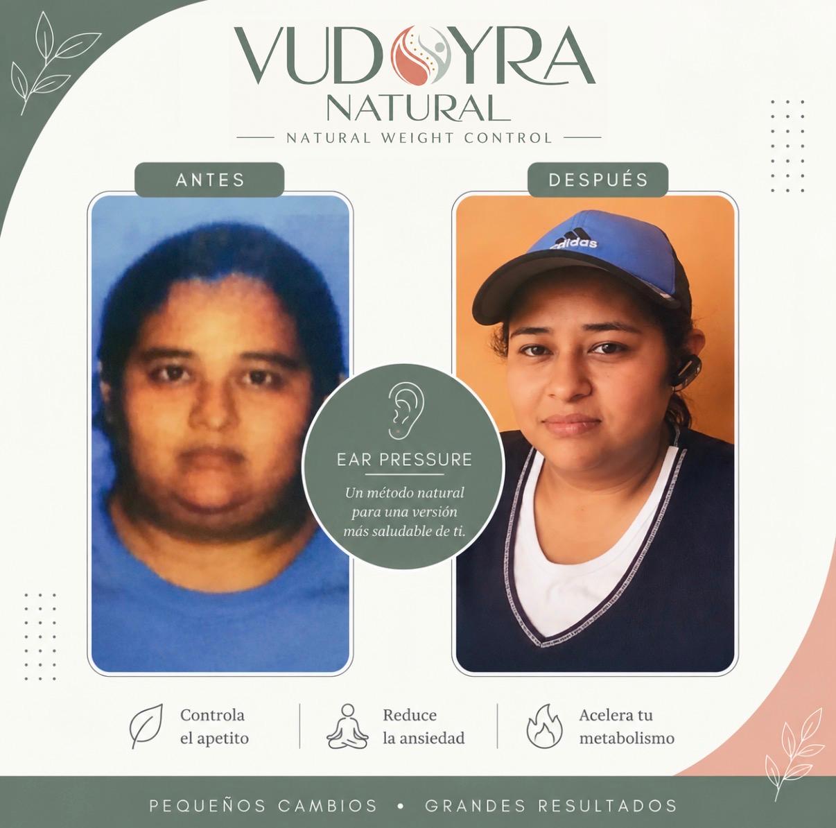 Antes y después — paciente 21